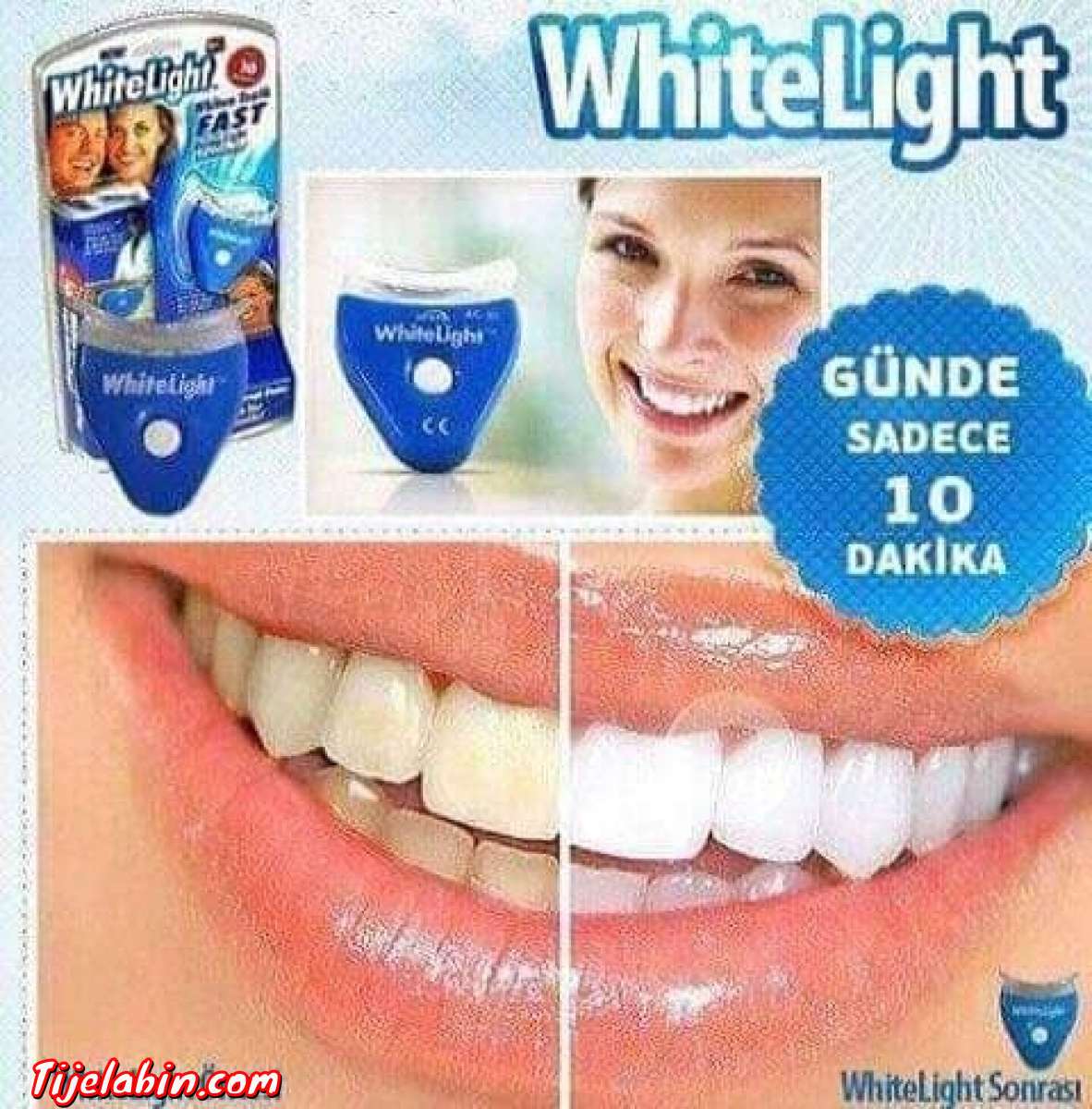 مبيض الاسنان