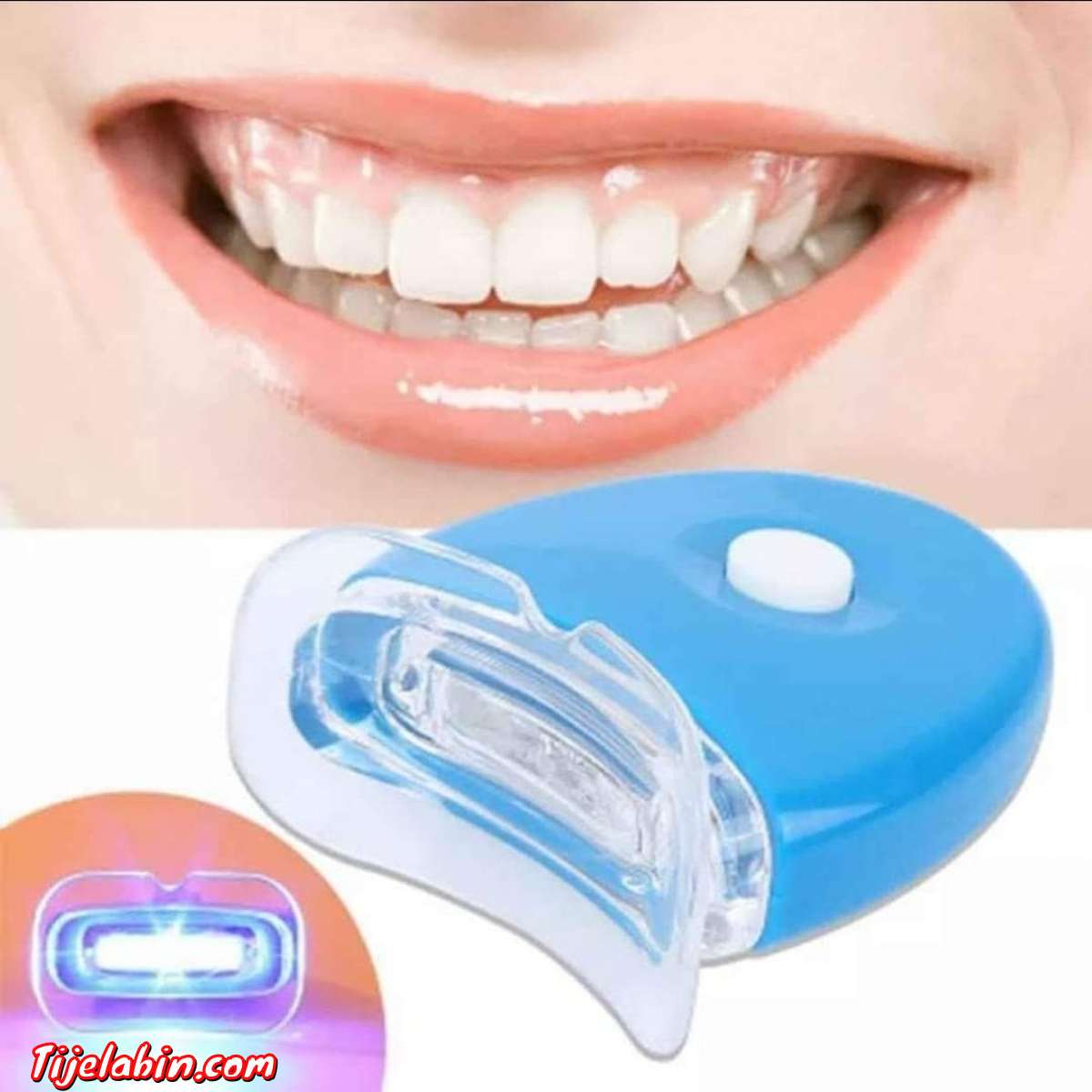 مبيض الاسنان