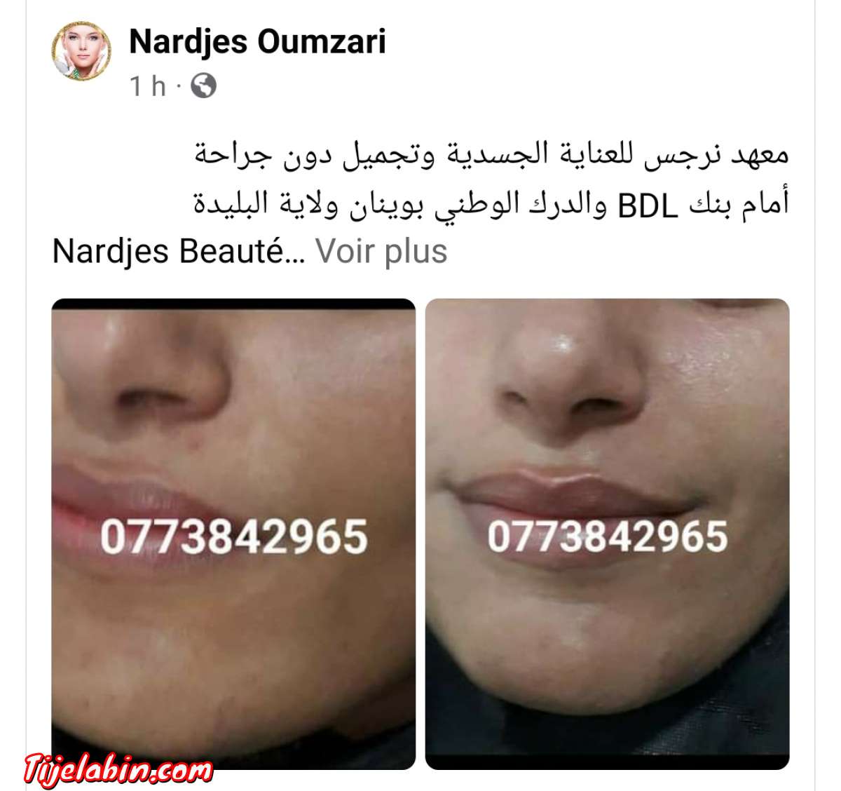 نتواياج دوبو