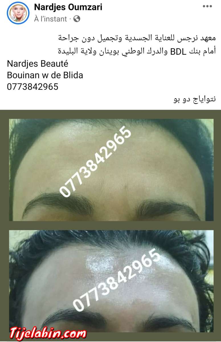 نتواياج دوبو