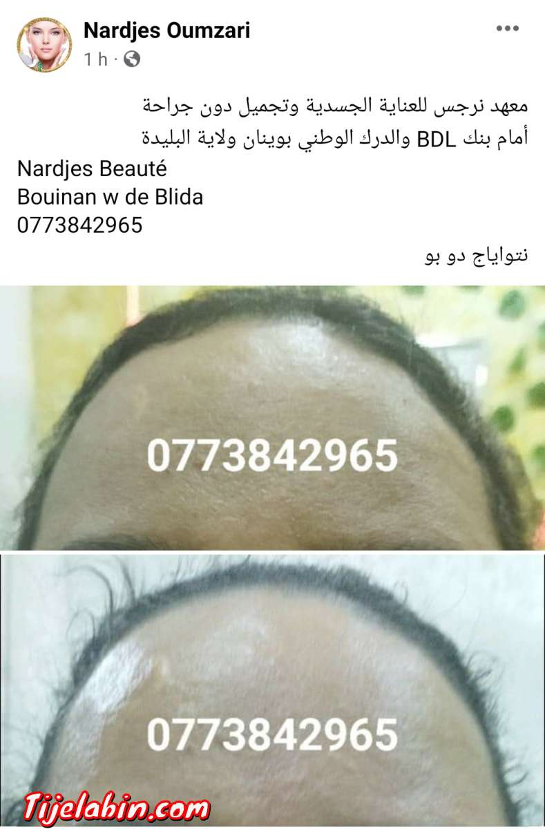 نتواياج دوبو