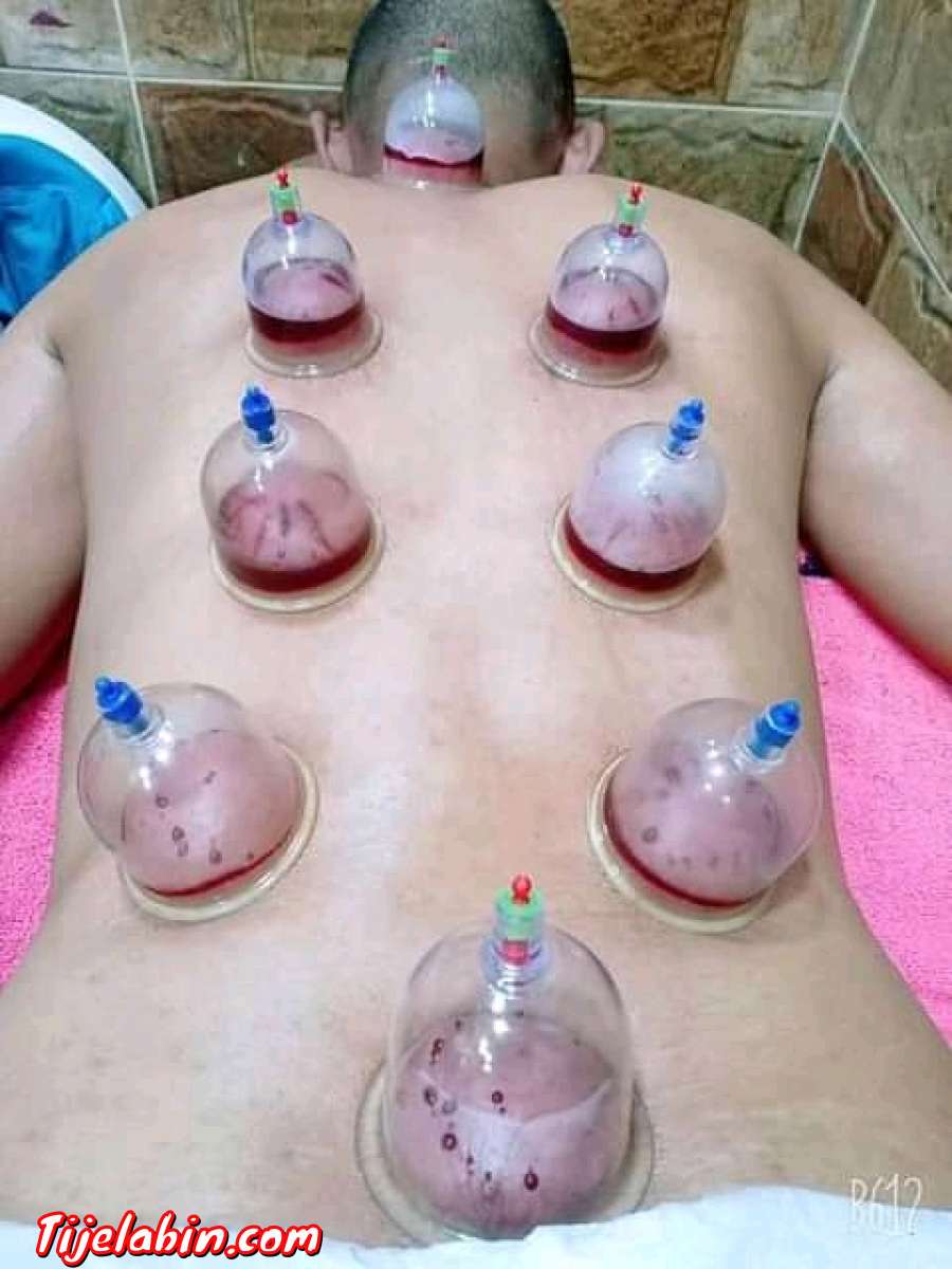 الطب البديل