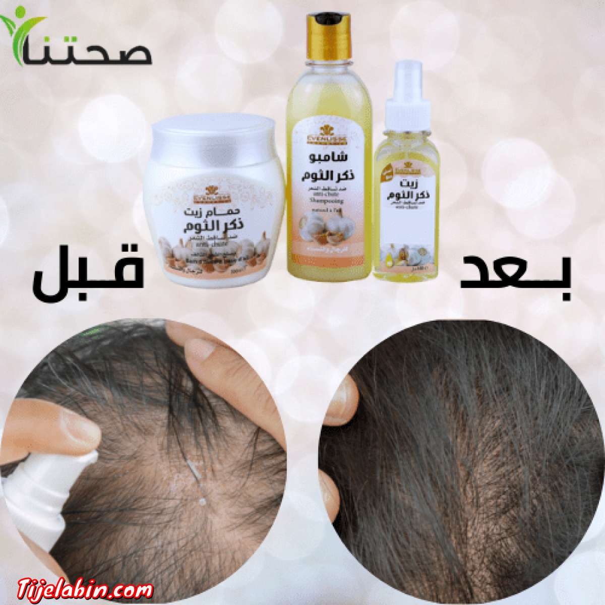 مع منتجات ايفنليس ، قولوا وداعا الشعر المترهل والمتساقط