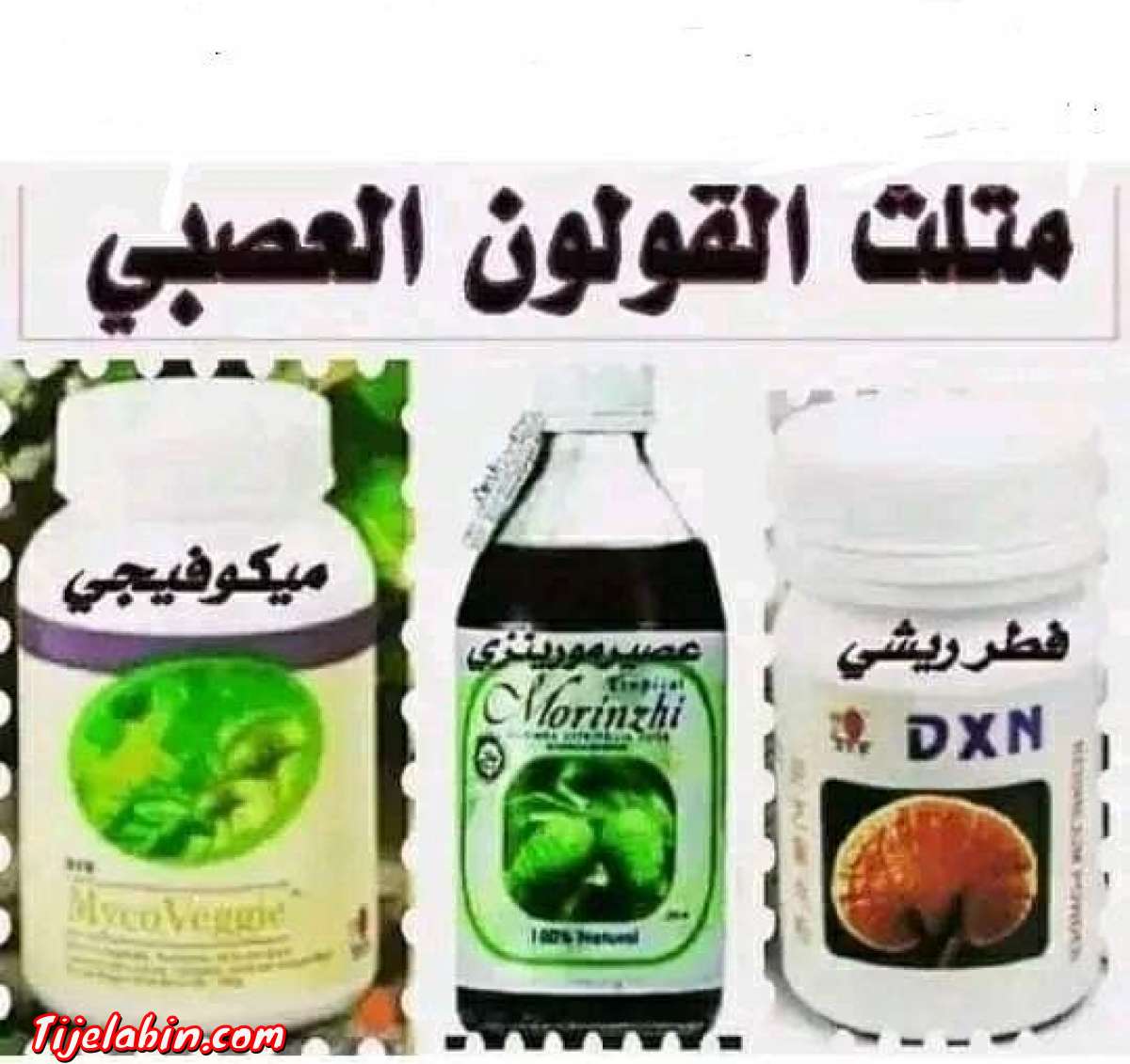 مثلث القولون العصبي