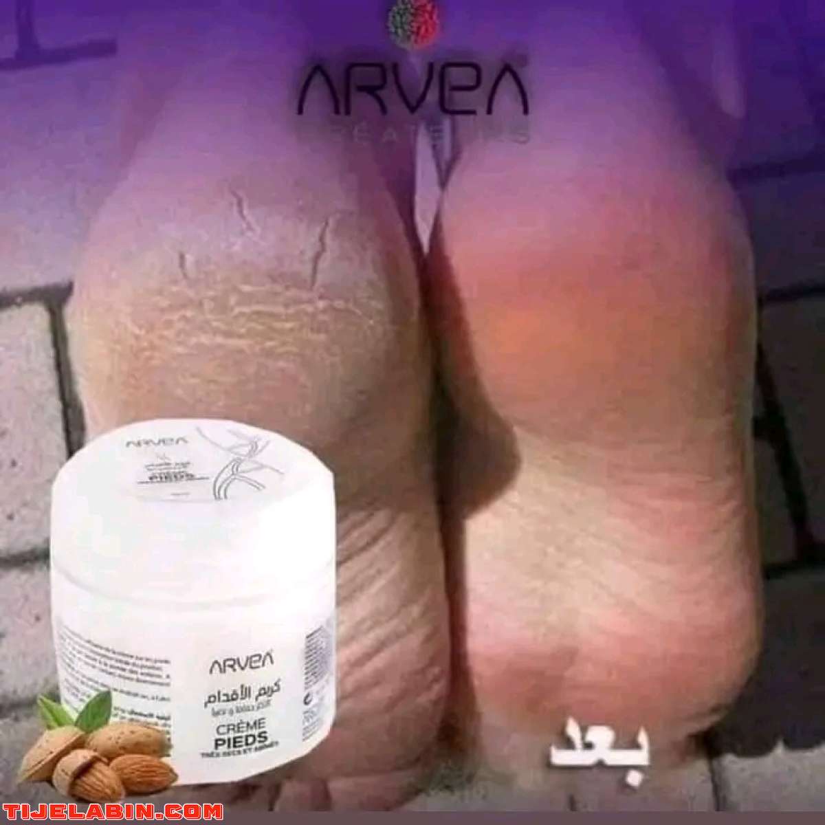 كريم الاقدام ارفيا