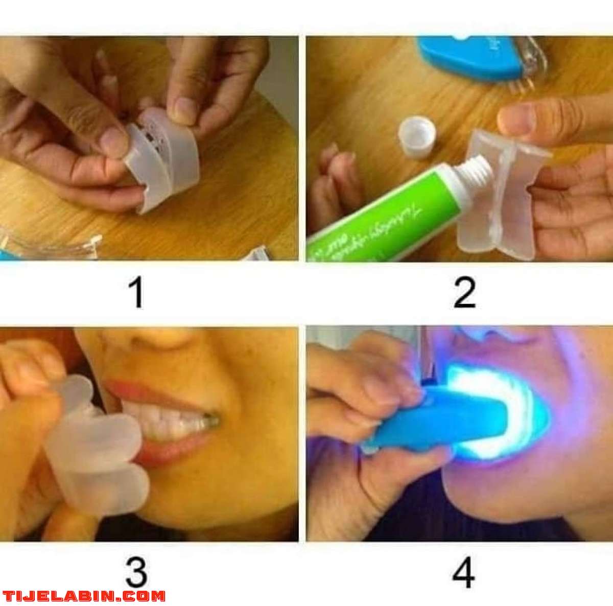 جهاز تبييض الاسنان الطبي بالليزر