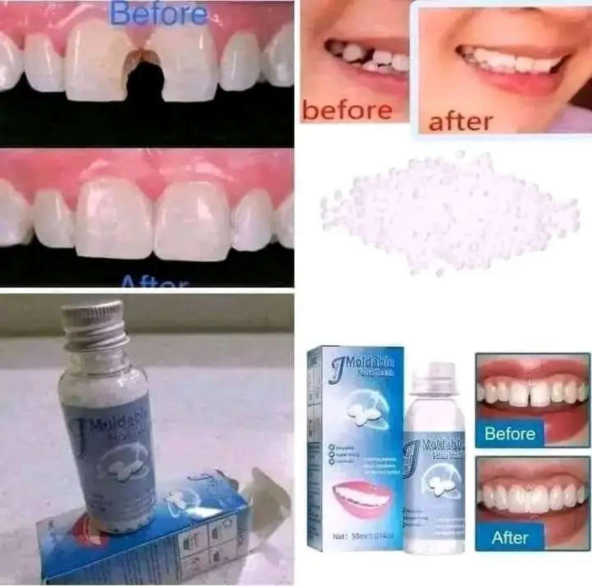 هل من الصعب تناول الطعام بدون أسنان جرب عجينة الأسنان