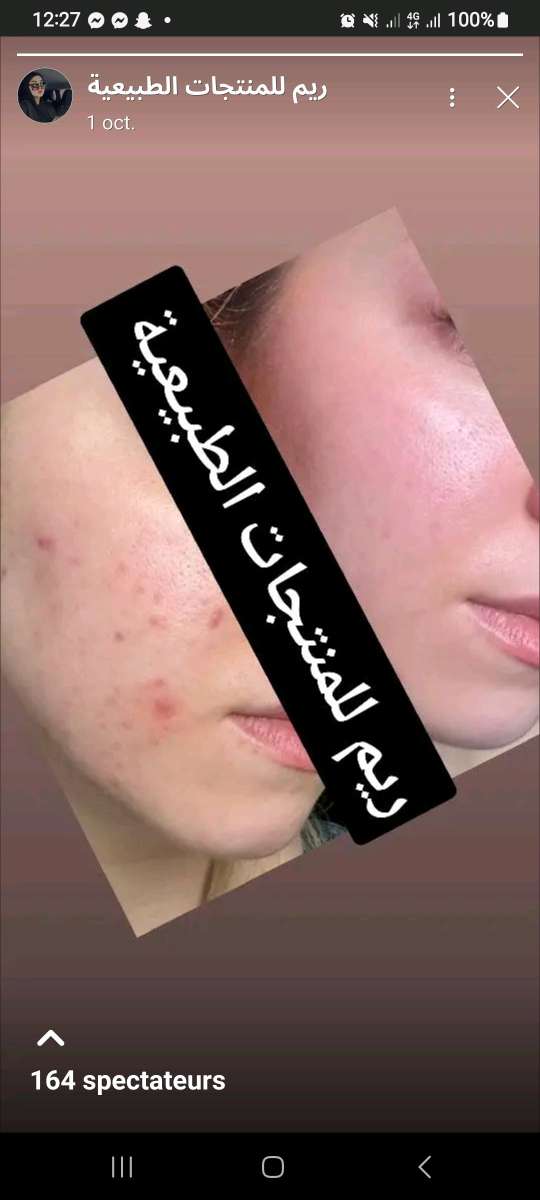 باقة فيتامين سي