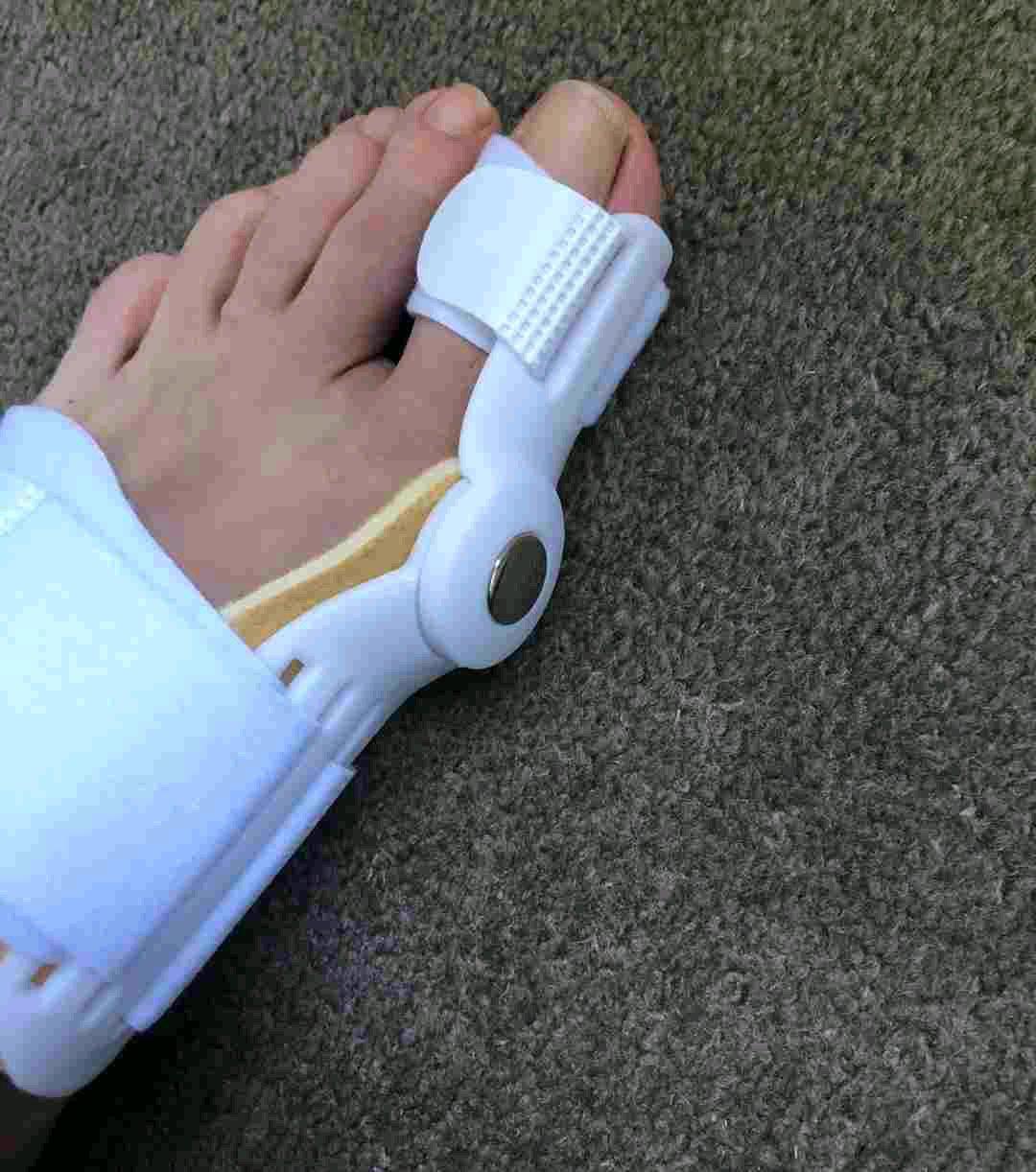 Hallux Valgus Schiene أداة تصحيح وضعية أصبع القدم