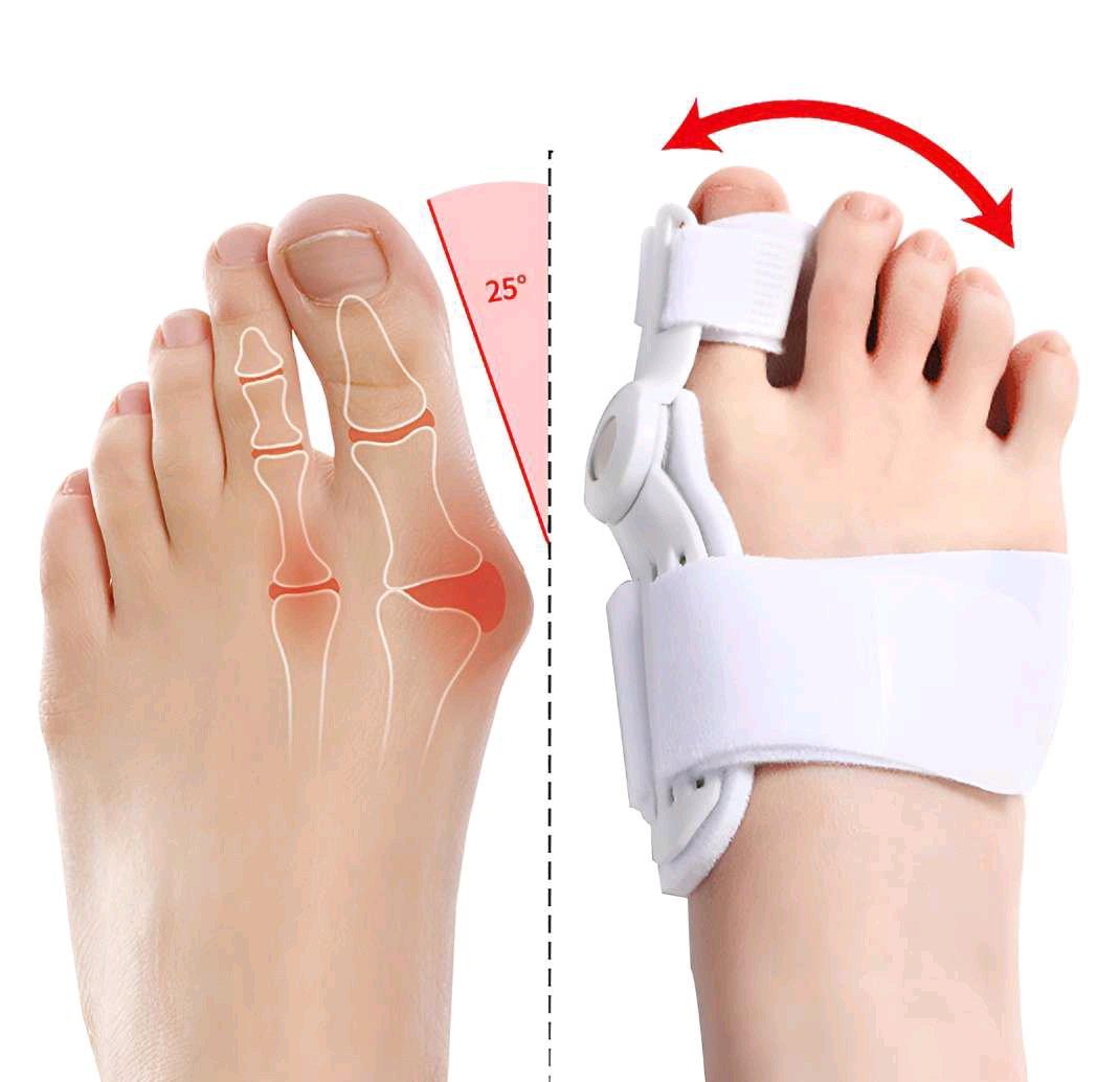 Hallux Valgus Schiene أداة تصحيح وضعية أصبع القدم