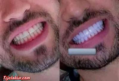 مبيض الاسنان - Thumbnail 4