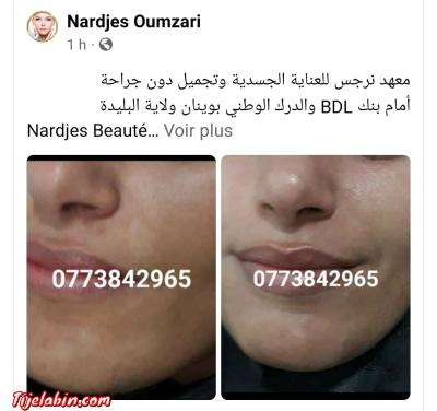 نتواياج دوبو - Thumbnail 5