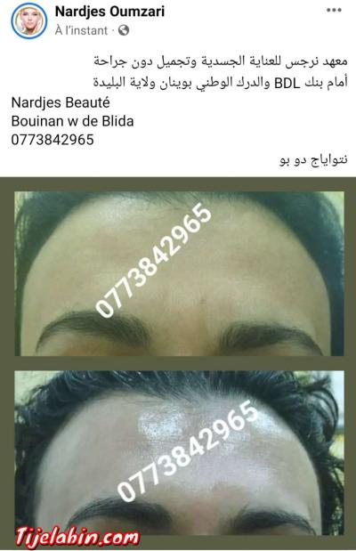 نتواياج دوبو - Thumbnail 4