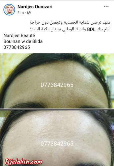 نتواياج دوبو - Thumbnail 2