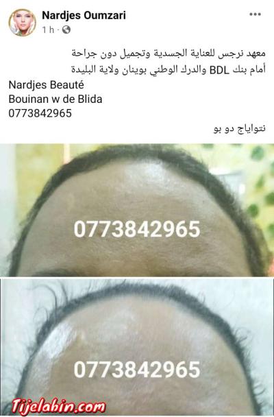 نتواياج دوبو - Thumbnail 3