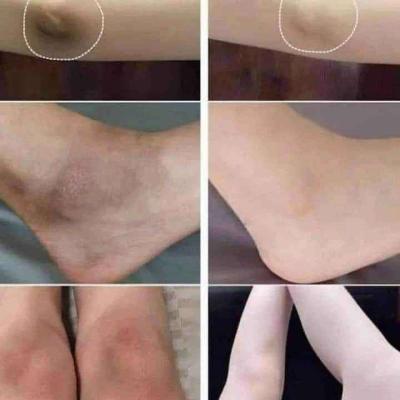 ماجيك دريم بلسم بخاخ لتفتيح البشرة Magic dream - Thumbnail 4