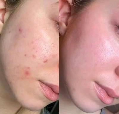 باك فيتامين سي - Thumbnail 4